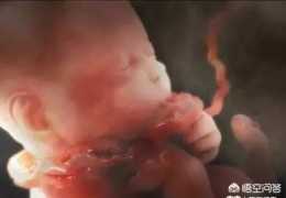 胎兒臍帶繞頸三圈，孕婦能不能順產呢？