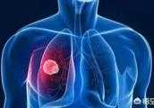 肺癌晚期該怎麼辦？